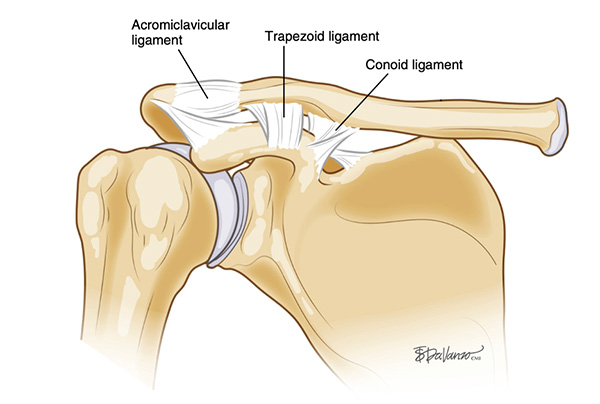 AC Joint Injuries - Zahab Ahsan, MD